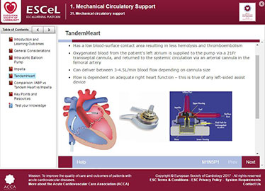 Image1_mechanicalcirculatory.JPG