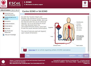 Image2_mechanicalcirculatory.JPG