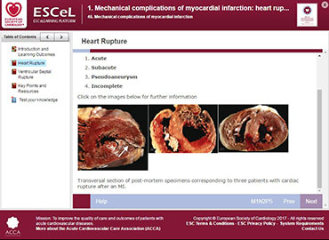 Image1_Mechanicalcomplications1.JPG