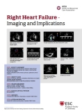 Right-Heart-Failure-imaging-implications.JPG