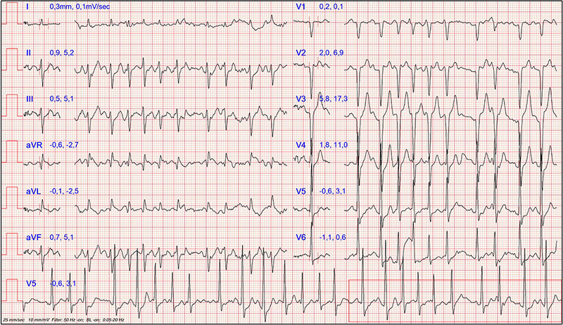 Quiz-18-Fig-2.jpg