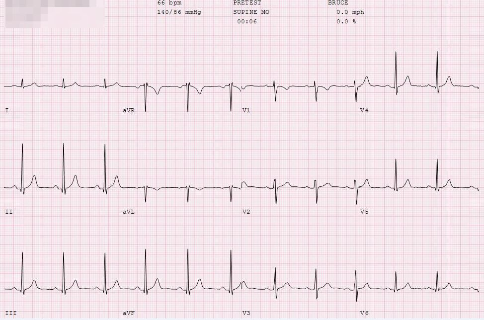 2020-sports-cardiology-case11-image1.JPG