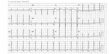 ecg-quiz-dec-2014-case-image.jpg