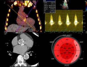 Multimodality Imaging Toolkit on Aortic Stenosis