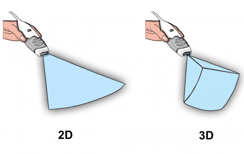 Comparison between 2D and 3D