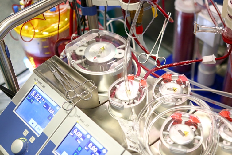 Cardiogenic Shock and Acute Mechanical Circulatory Support