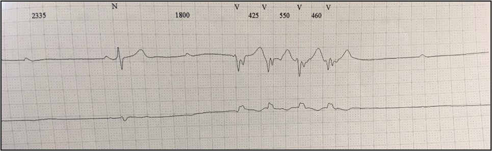 Clinical case_ Fig 2.jpg