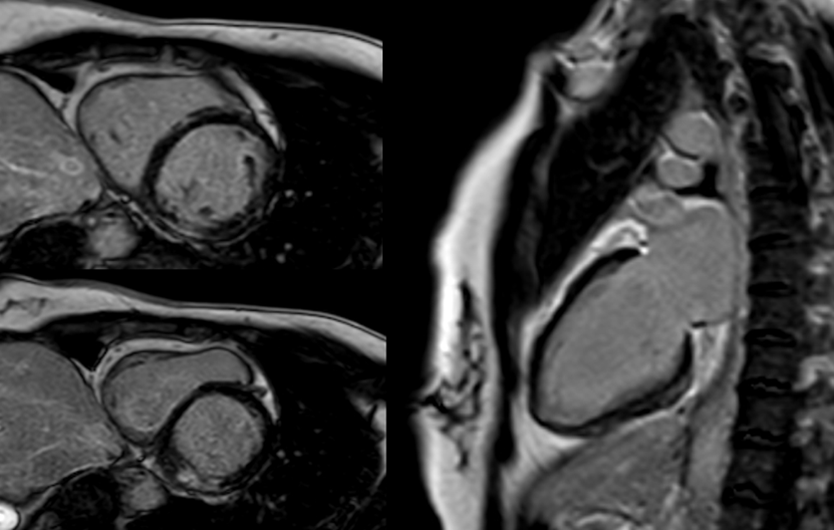 Vol 15 Genomic Insigh CC Figure 2.png
