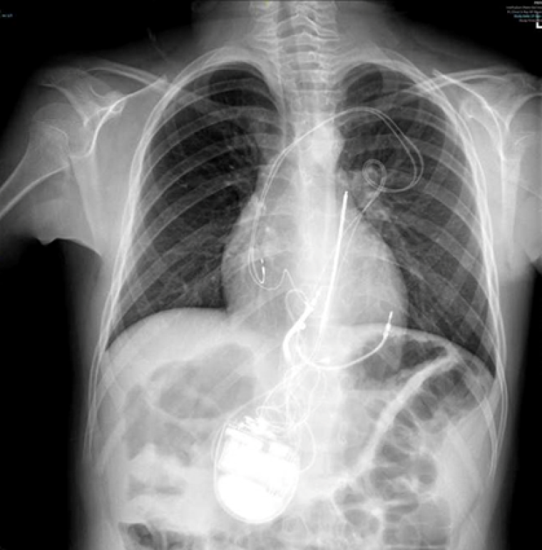 CC Vol 10 Picture4A.png