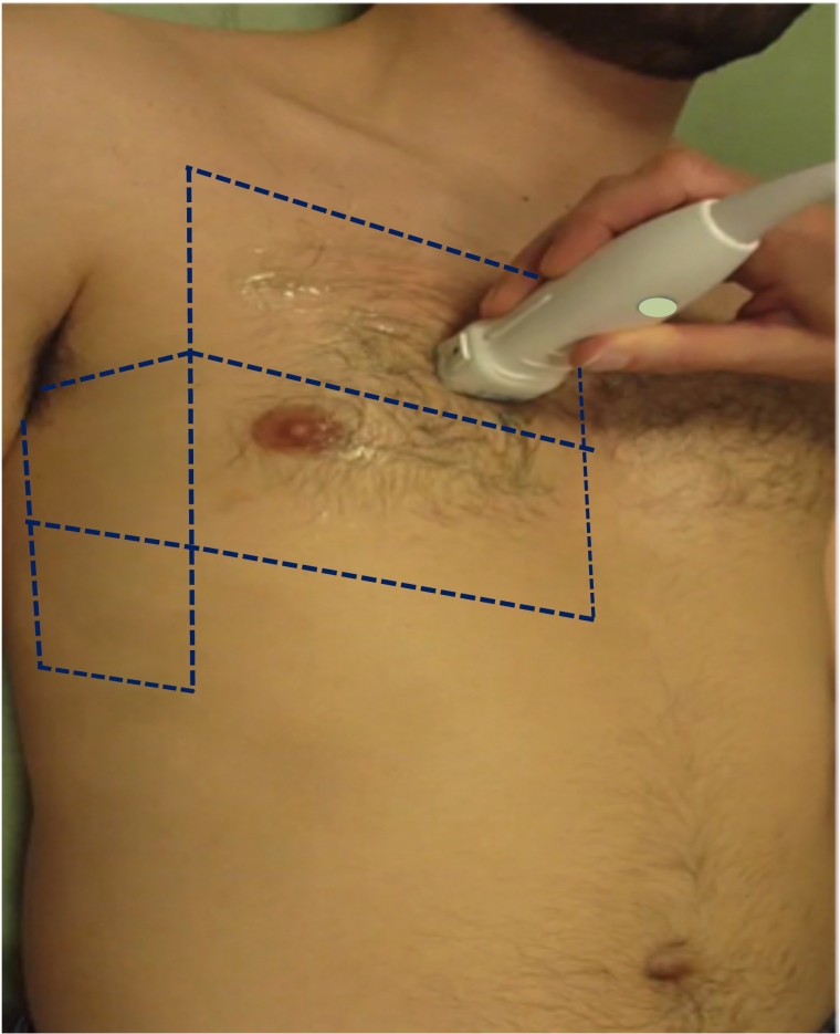 366_Gargani_Figure 1.jpg