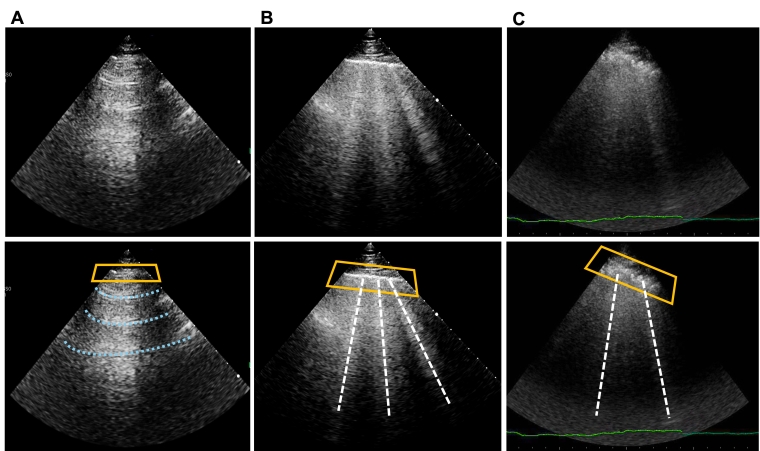 366_Gargani_Figure 2.jpg