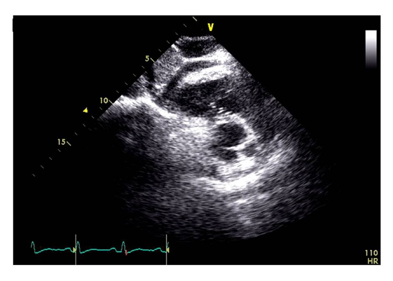 166_Galderisi_Figure 2.jpg