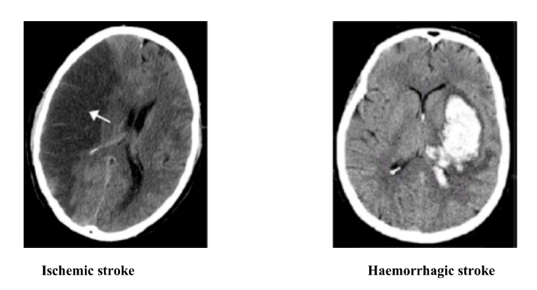 165_Abumuaileq_Figure 1.jpg