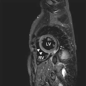 EJ-vol6-n31 fig 1