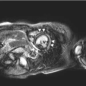 EJ-vol6 n31 fig 2