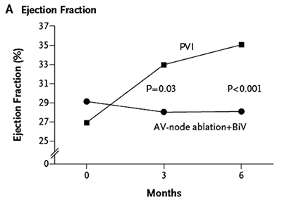 Cureus, Incessant Focal Atrial Tachycardia Leading to Tachycardiomyopathy