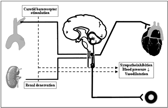 E-Journal of Cardiology Practice Vol8N23 - Figure 1