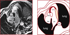 Imaging of the heart in horizontal long axis