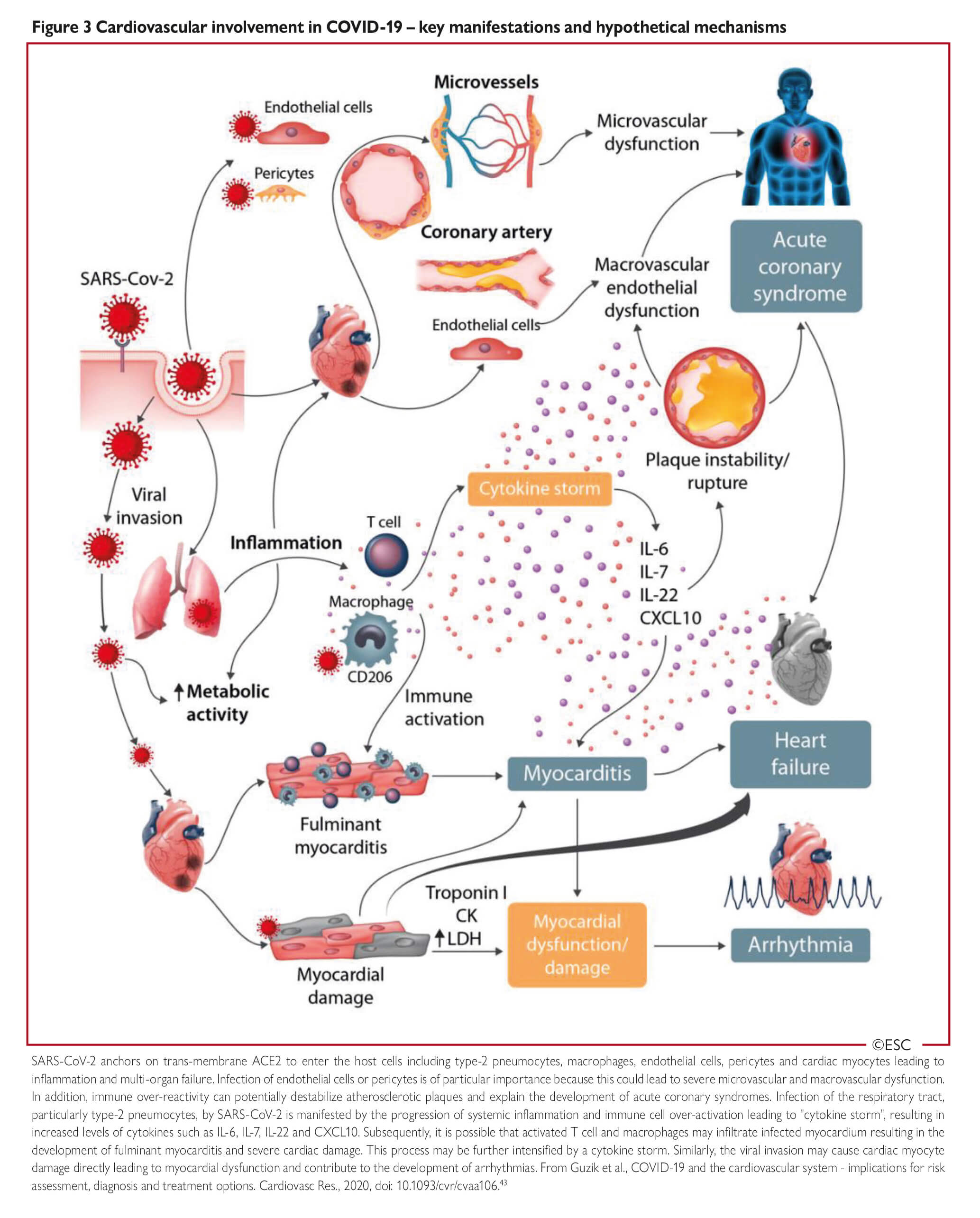 Esc Guidance For The Diagnosis And Management Of Cv Disease During The Covid 19 Pandemic