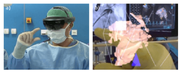  Figure 2: An example of a minimal invasive cardiac surgical procedure with mixed reality support. a) A physician wearing a Microsoft HoloLens headset manoeuvering the hologram by hand gestures. b) The physician's field of view. The holographic visualisation of three dimensional echocardiography data (CarnaLife Holo, MedApp S.A., Poland) streamed in real-time. In the background conventional computer monitors displaying patient's angiography and two dimensional echocardiography.