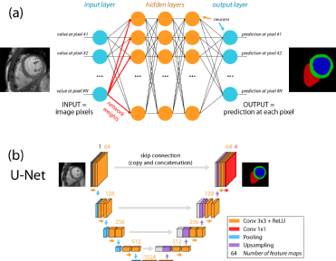 automatic-cardiac-segmentation.png