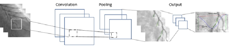 analysing-angiographic-images-computer-vision.jpg