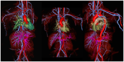 MRI-angiography-CMR-2018.jpg