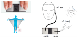 EHRA 2019 in-ear ECG photo.png