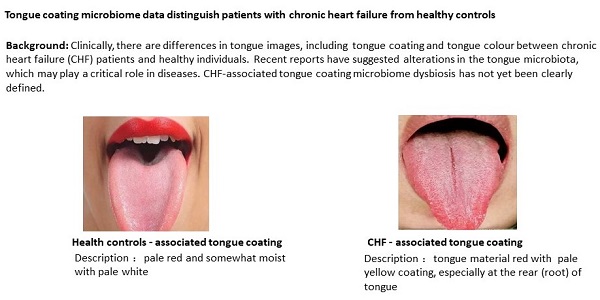 25 Disgusting Tongues and Medical Conditions Behind It I Stay at Home Mum