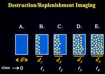 Destruction/Replenishment imaging