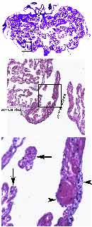 Invertebrate structure of heart