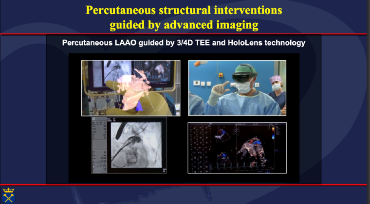 Percutaneous structural interventions guided by advanced imaging.png