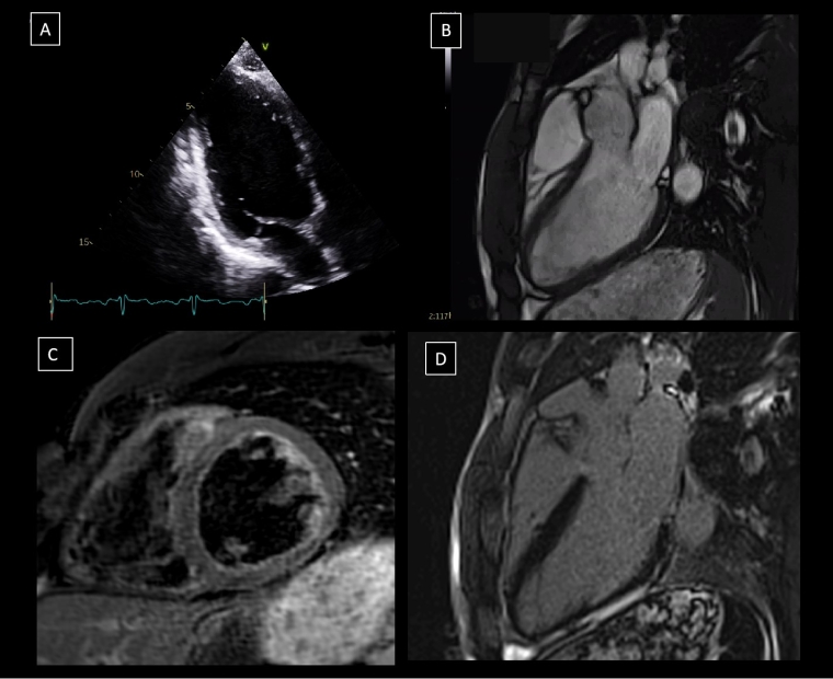 336_Sanz de la Garza_Figure 2.jpg